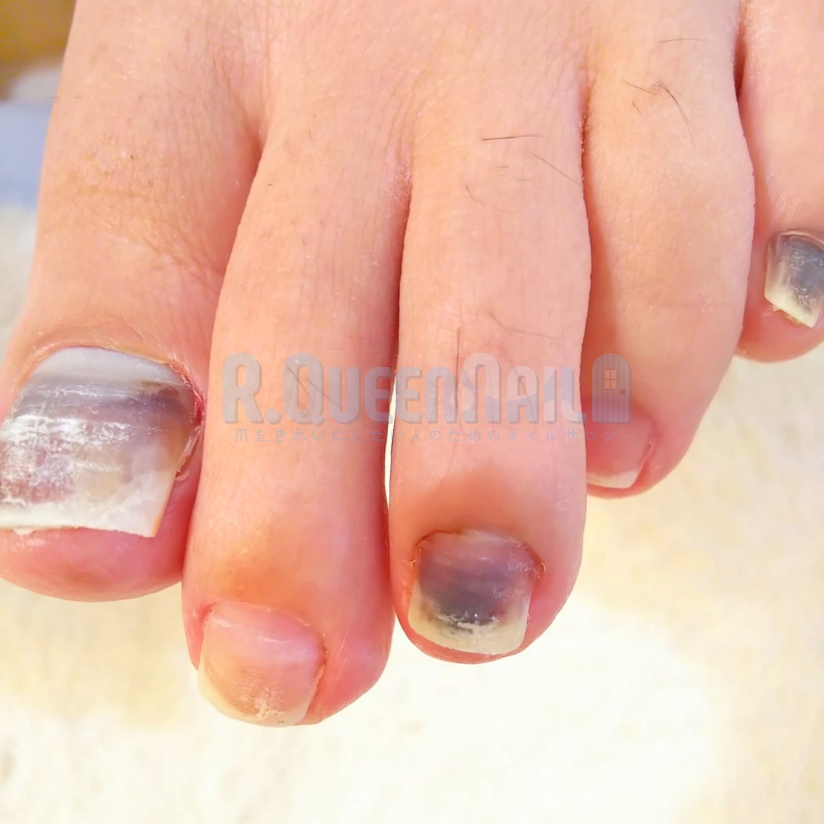 Tweets With Replies By 爪をきれいにしたい人のネイルサロンr Queennail Rqueennail Twitter