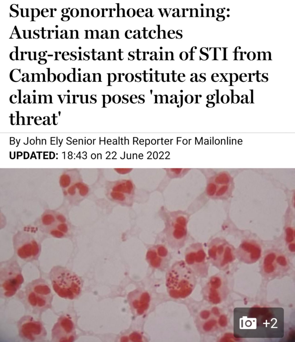 jimukgb's tweet photo. @MailOnline gonorrhoea is a bacterial infection, not a virus. I added a comment and rather than fix the error, your editors deleted my comments. Why? It's not in the public interest to feed false medical information to your audience #bbcnews #itvnews #channel4news #skynews https://t.co/pCjWgcJH7k