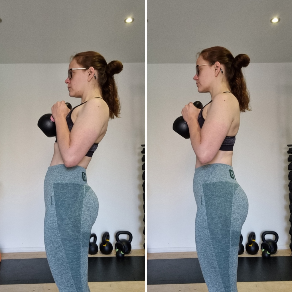 SMumstrong's tweet photo. If you look like the picture on the left at the top of your squat, deadlift etc, it could be causing low/mid back pain &amp; potential symptoms for your PF.

Finish in a stacked position &amp; keep glutes engaged to decrease tension in your PF &amp; lower back.

#iammumstrong #mumstrong https://t.co/BP05i8zXov