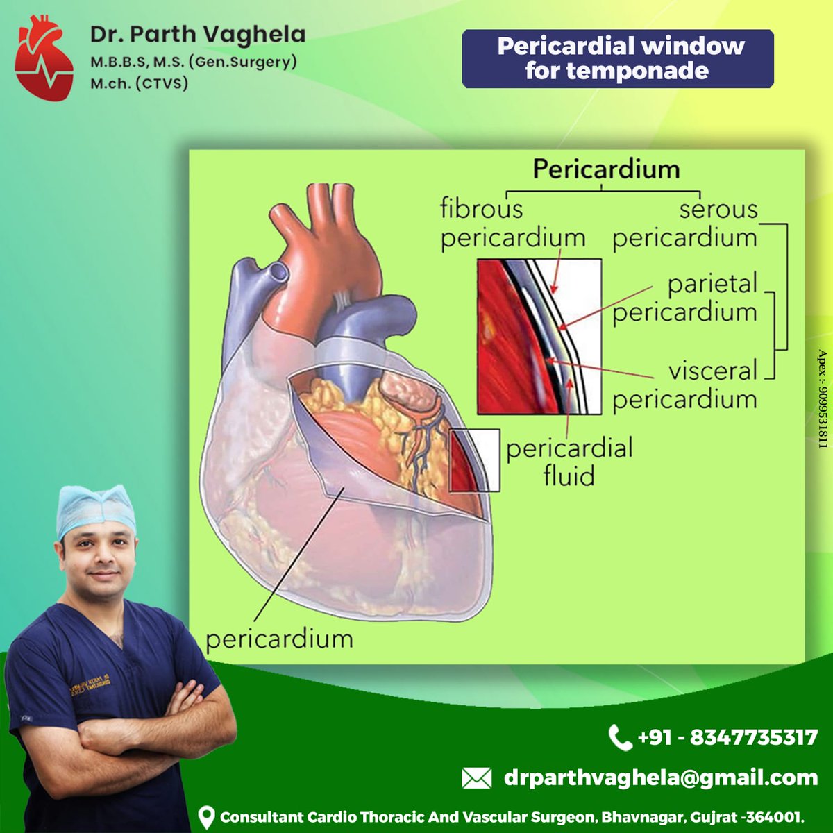 Pericardial Window For Temponade

#pericardialwindow #temponade #pericardium #fibrouspericardium  #serouspericardium #parietalpericardium #visceralpericardium #pericardialfluid #drparthvaghela #doctor #hospital #endovenouslasertreatment #CTVS #cardiothoracicsurgery