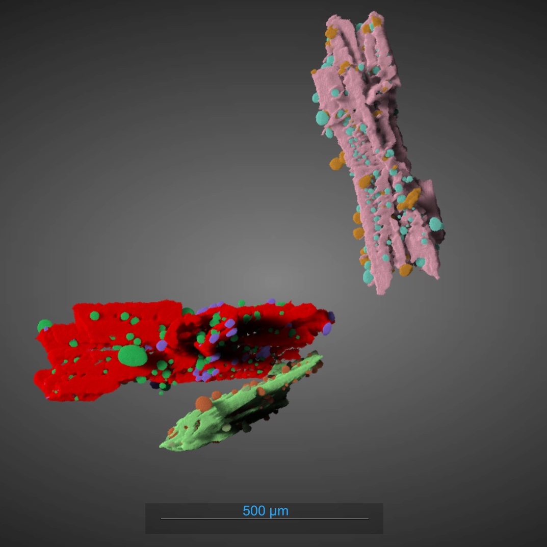 Picturesque #3D reconstruction of SR-μCT data of #experimental #clinopyroxene crystals.

#Petrology #Volcanology #Stromboli
<a href="/HPHTLab_UNIPI/">HPHTLAB_UniPi</a>