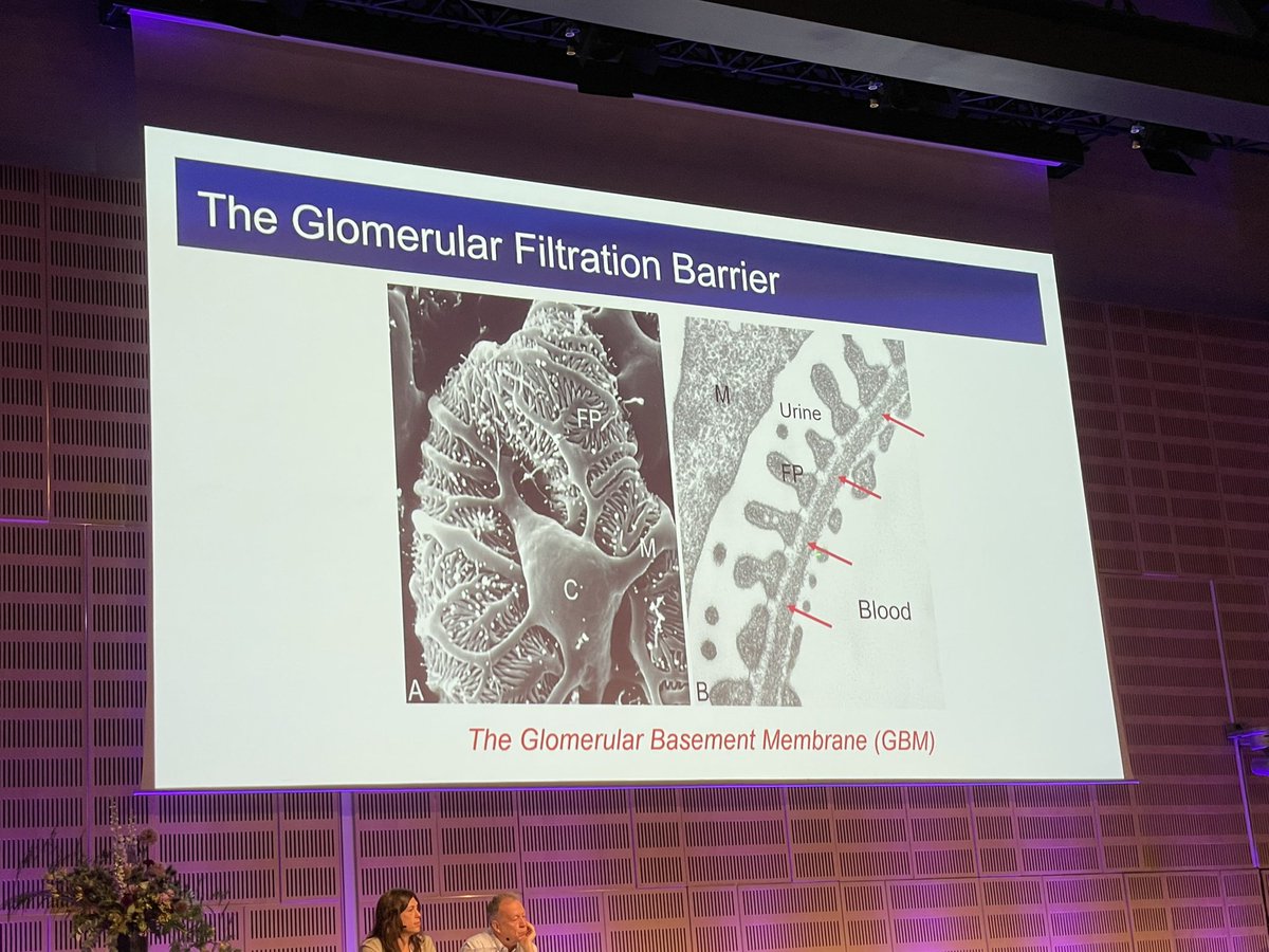 IPFdoc's tweet photo. Excited to hear about the basement membrane and it’s major proteins laminin &amp; collagen 4 in renal disease @ecmcongress2022 #DEMISTIFI. Will it provide learning for us to #CureIPF? https://t.co/IJwbUVKAlL
