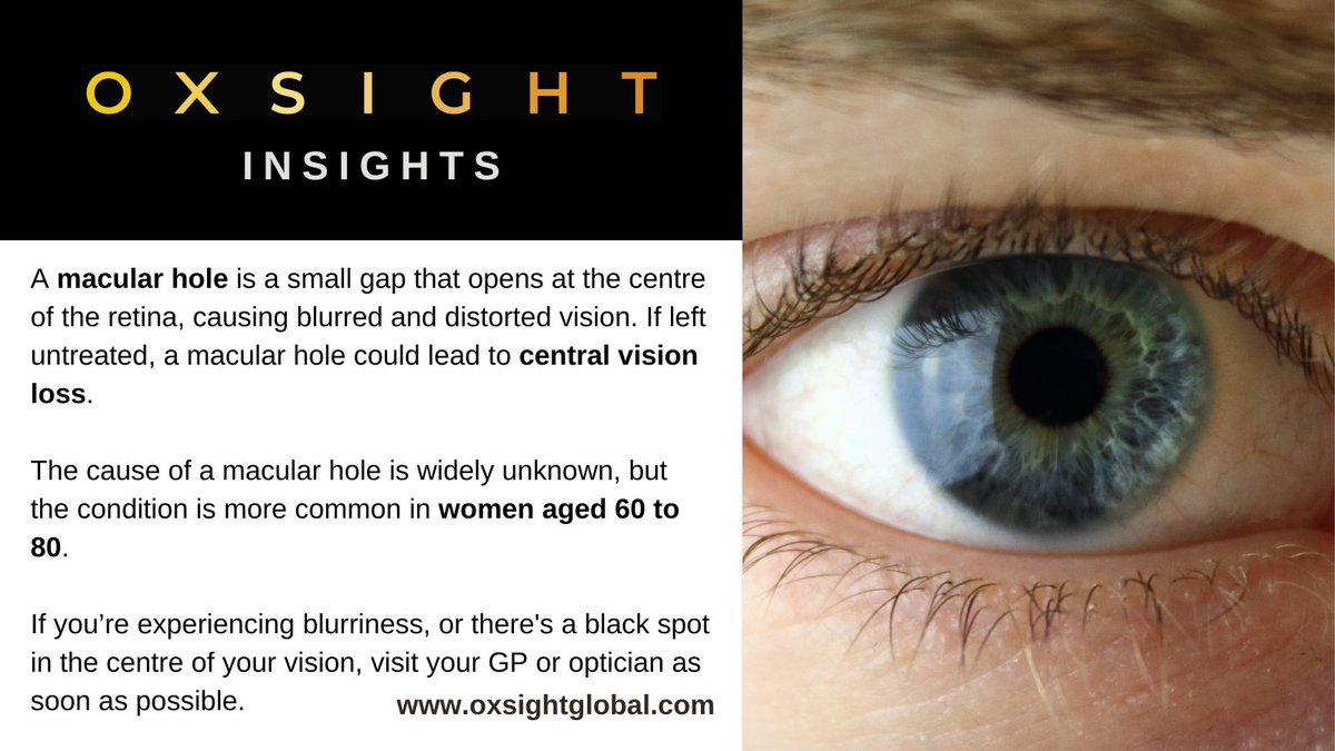 As it’s #MacularWeek, this month’s #OXSIGHTInsights is looking at a condition known as a #MacularHole. Causing blurry vision and #CentralVisionLoss, a macular hole is a small gap that opens at the centre of the retina. Read more below and visit the <a href="/MacularSociety/">Macular Society</a> for more info.