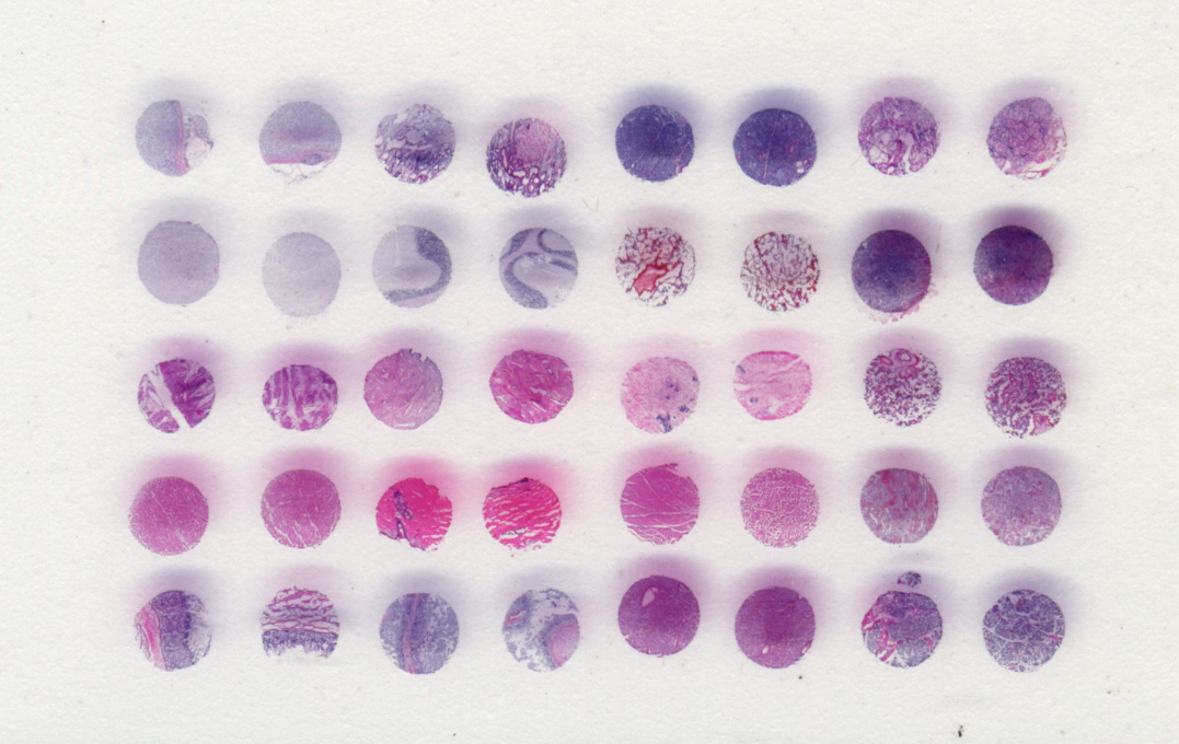 Immunodeficiency tissue profiling:
19 tissue blocks x 119 antibody targets = 2261 microscopic slides