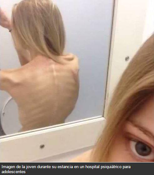 #DENUNCIA ☎️062 los grupos de #Whatsapp, foros y páginas web que inciten a la anorexia o la bulimia
Tú eres más que tu talla