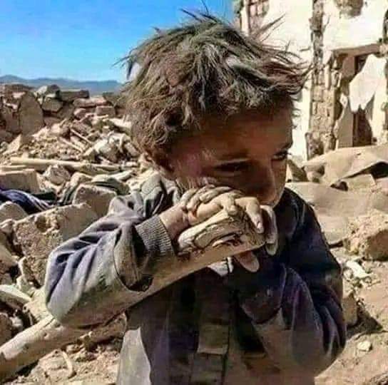 PositiveAfghan3's tweet photo. لکه شهید مې چې وي ورور درپسې وژاړمه 
ویجاړ وطنه  څومره  نـــور د
رپسې وژاړمه 

😭😭😭  اخ دوطن غم! 
د بېوسۍ وروستی حد
رب ذوالجلال دې شهيدانو ته جنت الفردوس او ټپيانو ته عاجله شفا ورکړي. https://t.co/R1EjZI37Od