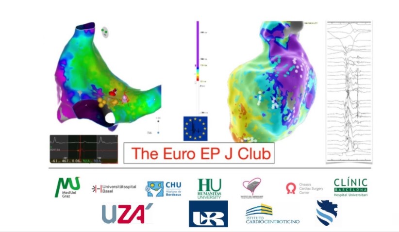 ❤️‍🔥EURO-EP JC❤️‍🔥

⏰Today at 17:15

🚨Topic: Early VT Ablation in SHD: A Must?

By the great <a href="/martaderiva/">Marta de Riva</a> from <a href="/EP_Leiden/">Leiden Electrophysiology</a> 

Join us for free: us02web.zoom.us/meeting/regist…

<a href="/aportasanchez/">Andreu Porta Sánchez</a> <a href="/GiulioConte9/">Giulio Conte</a> <a href="/MBergonti/">Marco Bergonti</a> <a href="/K_Letsas/">Konstantinos Letsas</a> <a href="/finnakerstrom/">Finn Åkerström</a> <a href="/DanielScherr3/">Daniel Scherr</a> <a href="/BadertscherPat/">Patrick Badertscher</a>  <a href="/Petr_Peichl/">Petr Peichl</a>