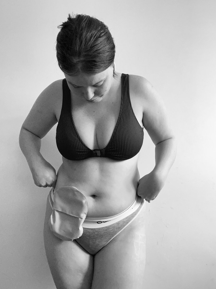 DanniRowson's tweet image. Mix &amp;amp; matchin today 😆🙌❤️ #ileostomybag #bodyconfidence #chronicillness #colorectalsurgery @ColostomyUK @Coloplast_UK @Charter_UK @iasupport @MeetAnOstoMate @Comfizz