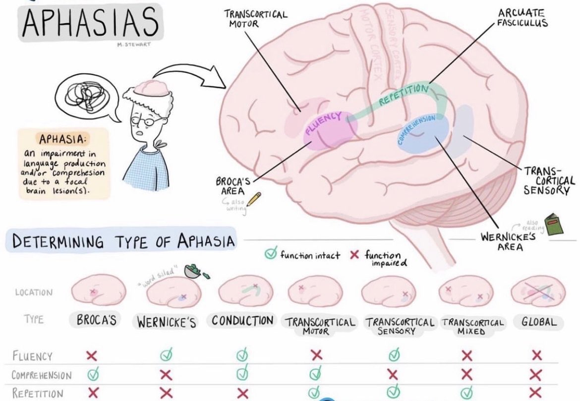 OGdukeneurosurg's tweet image. Some basics on determining the type of aphasia.