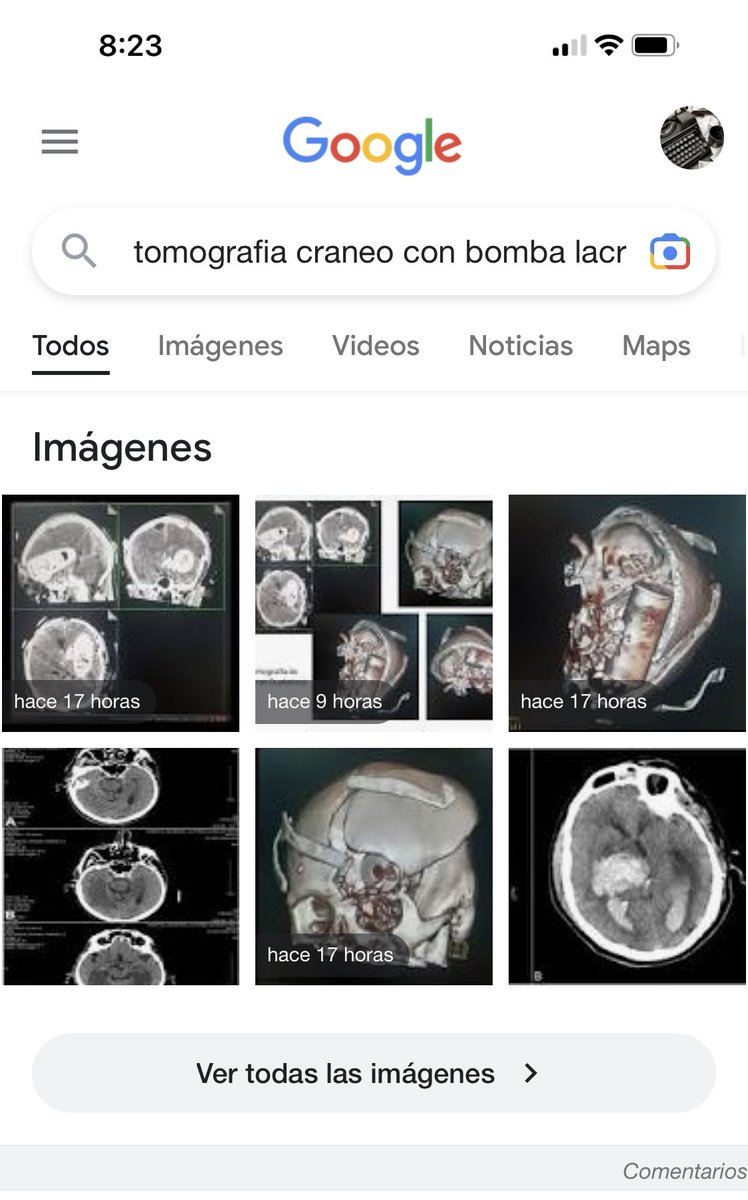 AdrianSaltos11's tweet photo. @janethinostroza @GKecuador @CONAIE_Ecuador Creo q la gran mayoría obvia esto último, pero quiere poner q se pueden encontrar fácilmente en internet, cuando literalmente han sido subidas en la sultimas 24 horas, si me ayuda encontrando algo similar pero con fecha anterior para verificar su "profesionalismo" https://t.co/bl12P7XNp5