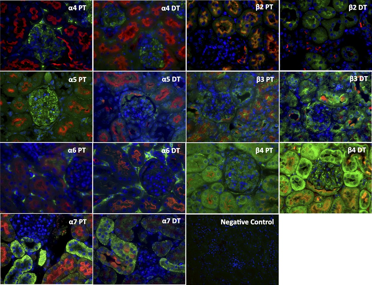 Fig 8- Expression of nicotinic acetylcholine receptors (nAChRs) in normal mice. 
By: Edgar A. Jaimes, et al.
🔓ow.ly/KV4q50JCYcN
#ImageOfTheWeek #Nicotin #Smoking <a href="/MSKCancerCenter/">Memorial Sloan Kettering Cancer Center</a> <a href="/umiamimedicine/">Miller Medicine</a> <a href="/ejaimes63/">Edgar Jaimes</a>
