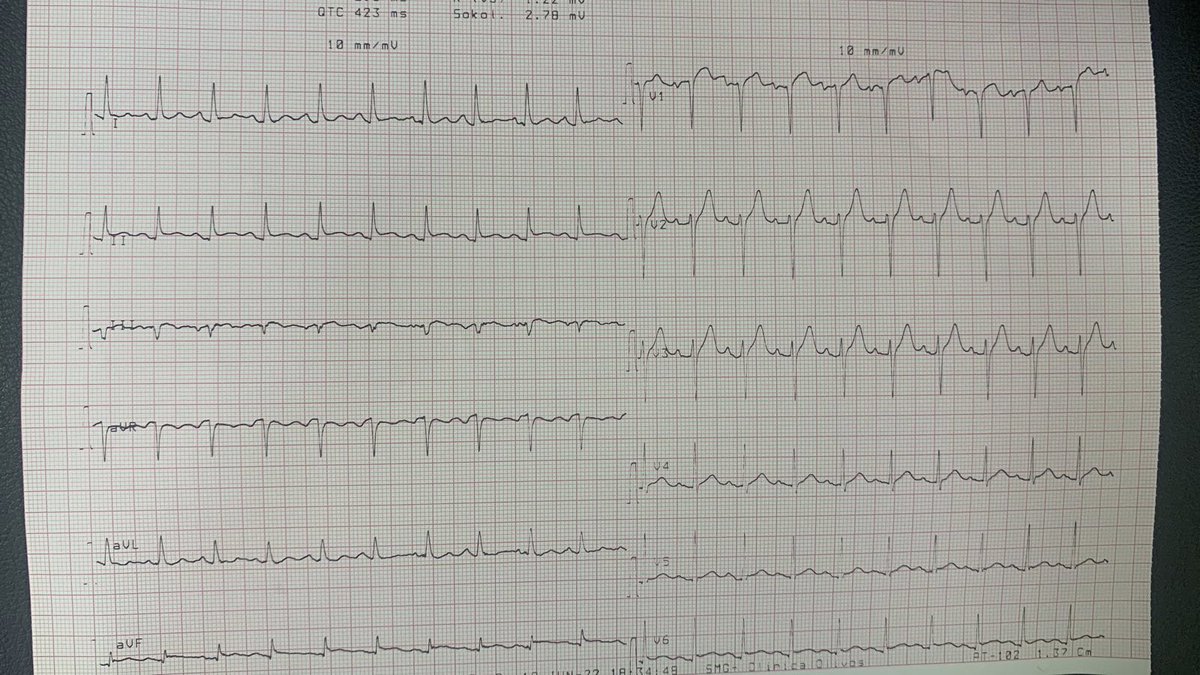 Gonzalo Perez tweet media