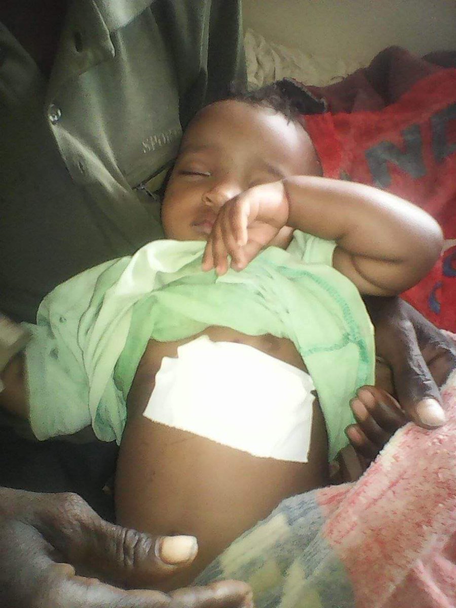 WAGSHUM133's tweet photo. This is a 4years kid whose family are killed by #oromiaMassacre and he is wounded by gunshot of the terrorists😭
@EthioHRC @UNHumanRights @hrw @WHO @PowerUSAID https://t.co/HUwFH9afx2