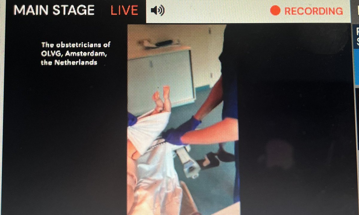 myobstetrician's tweet photo. @NandaSurabhi @SisterShawnRM updating on #multiplepregnancy and #breech birth @RCObsGyn @BMFMSNews #MLW22 #birth #labourward #maternitysafety https://t.co/0MUKOxx98U