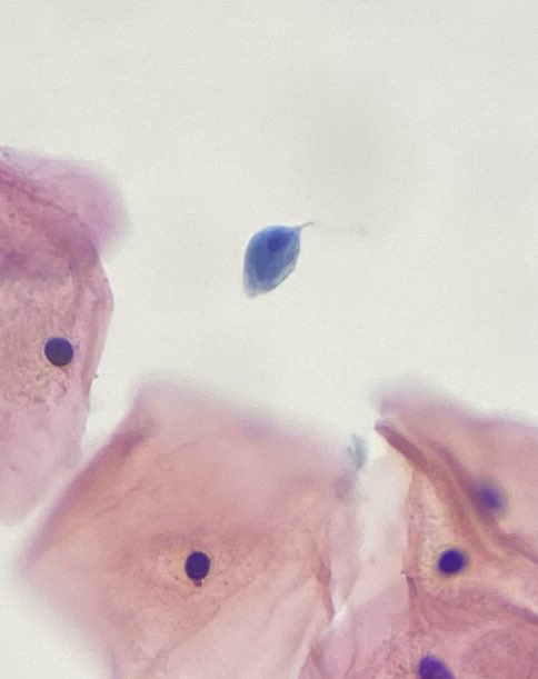 Que mona la trichomona! 🐒 #PathTwitter #Pathology