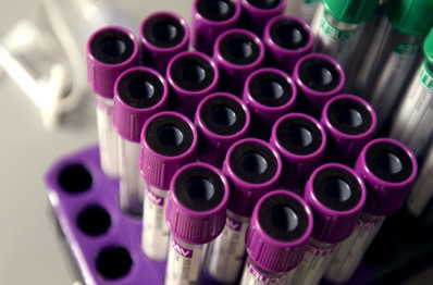 MedsharpsSA's tweet photo. Concerned about the safe disposal of biohazardous and infectious materials? MedSharps can create a medical waste management plan specific to your hospital, clinic, or medical practice. We also provide a safe and secure disposal service for labs too. #Medicalwaste #Safetyfirst https://t.co/p0oGIeA7MI