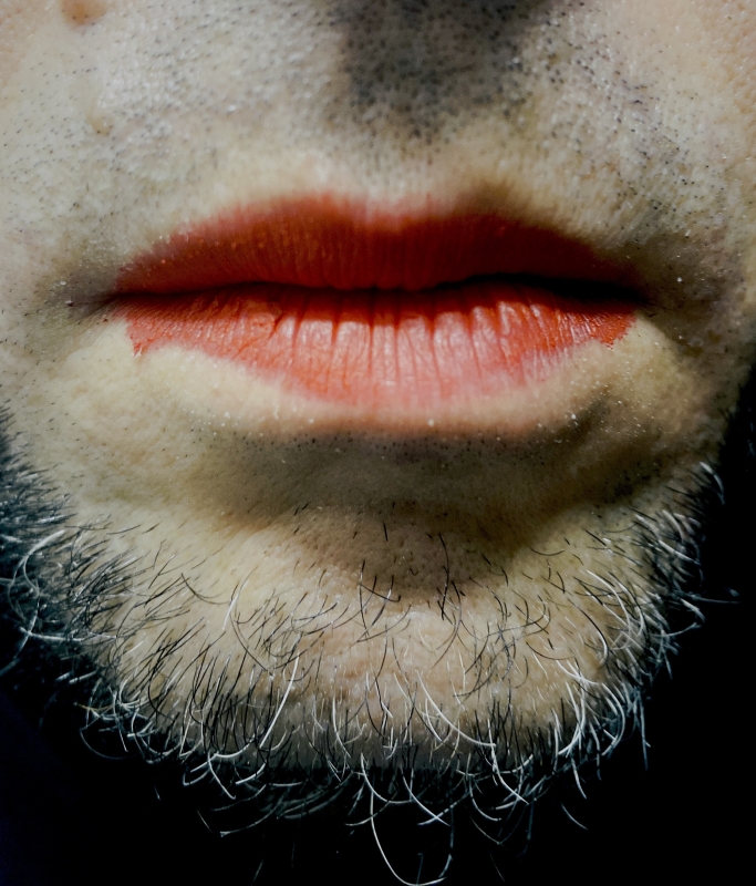 butt-kissing a clown.
Berlin, June 2022