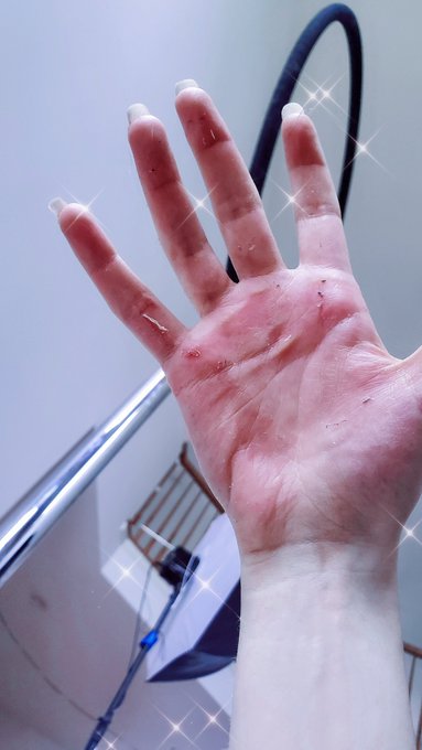 Its not always pretty.  But then again, I guess thats why we have glitter.  PROBLEM SOLVED🎃;;  #circuslife<a href="/tag/circuslife"class="tags"><span>#circuslife</span></a><a href="/tag/aerialfitness"class="tags"><span>#aerialfitness</span></a>