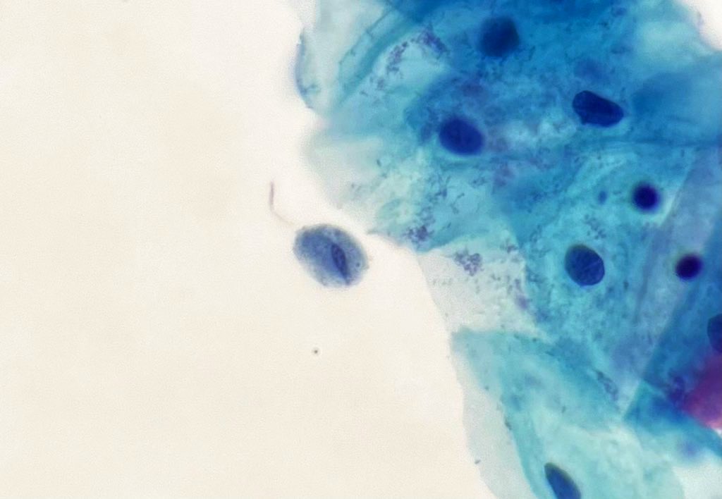 Trich model #cytopath