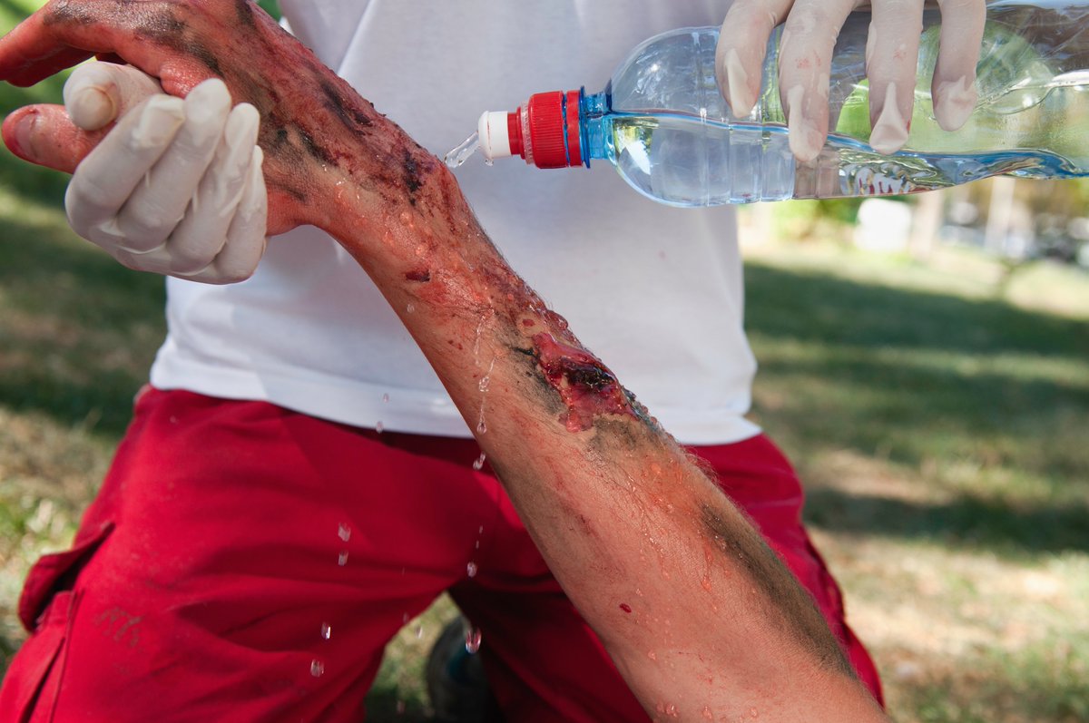 WalshTrainingS's tweet photo. Expose and examine  the injured area before  deciding treatment of the injury. Contact us now for more information regarding training #walshtrainingsolutions #FAR #REC3 #CFR #rescueemergencycare #firstaidtraining https://t.co/un6KqGGyZt https://t.co/H7O5HfORUH