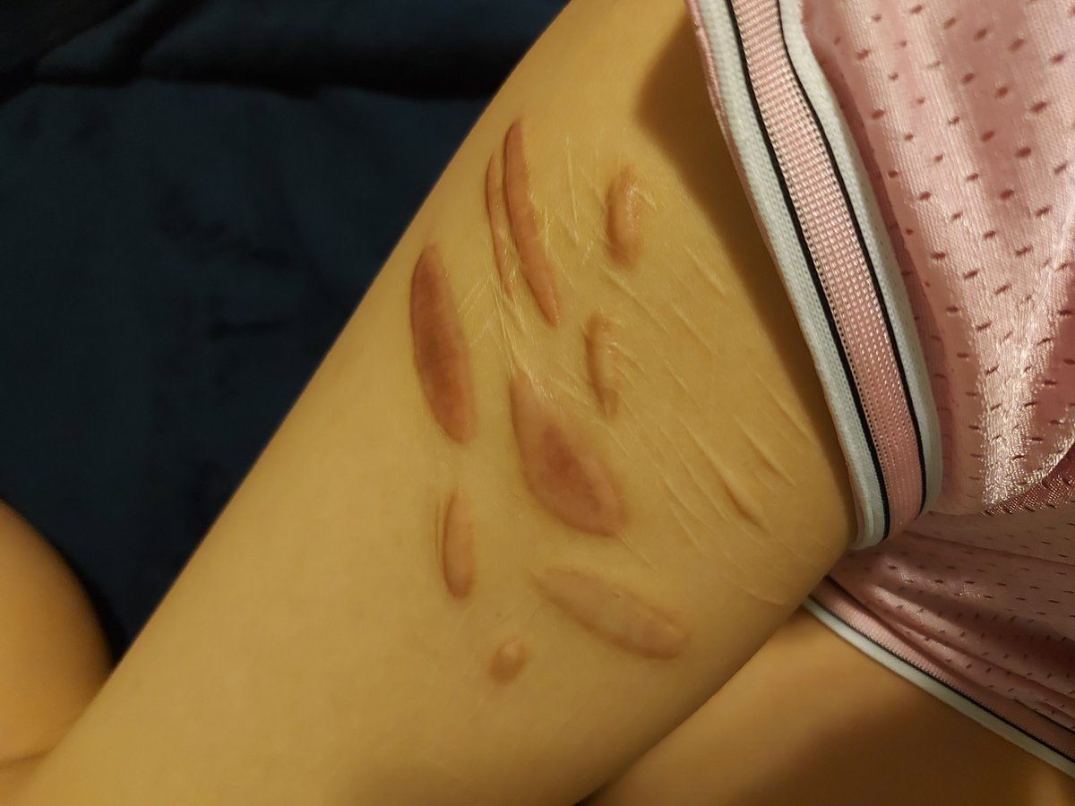 SliceyBear's tweet photo. Why yes, I did have a favorite thigh, how could you tell? https://t.co/3AEsbTITGM