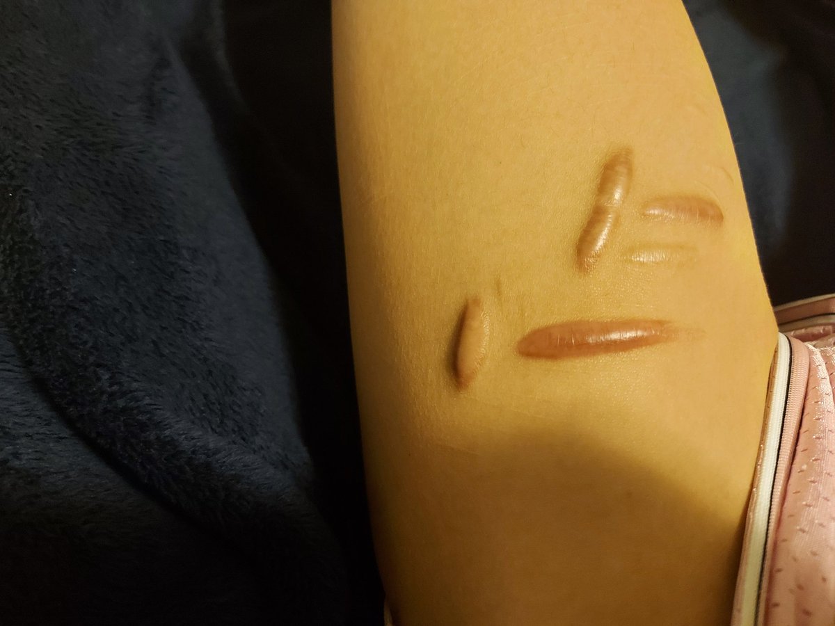 SliceyBear's tweet photo. Why yes, I did have a favorite thigh, how could you tell? https://t.co/3AEsbTITGM