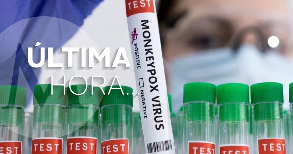 Milenio's tweet photo. #ÚLTIMAHORA | Confirman segundo caso de viruela del mono en Ciudad de México

https://t.co/2HMUMzCVNC https://t.co/pAR2BpTUzL