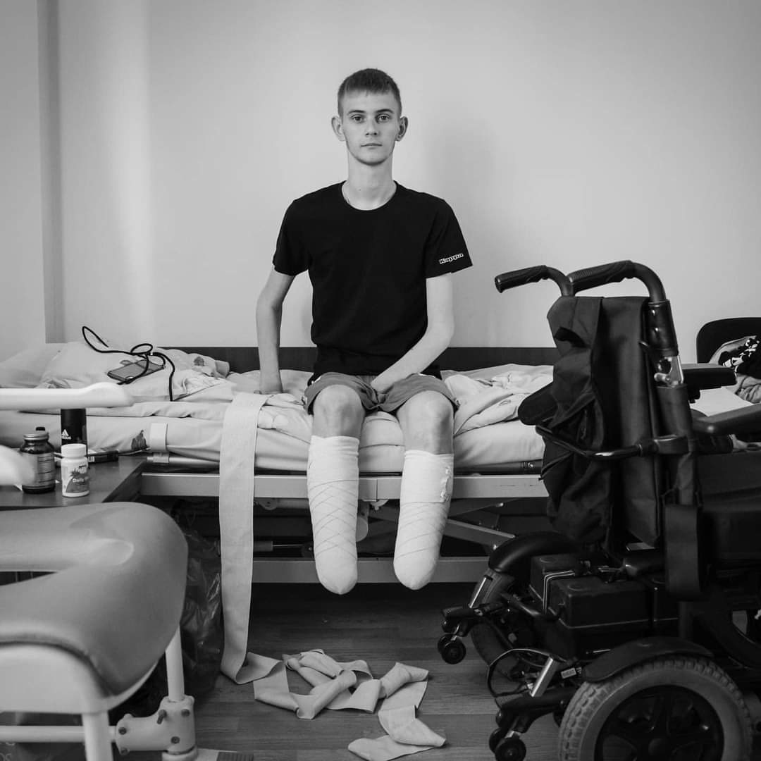 InnaSovsun's tweet photo. Dalyl is 19 years old. He joined the army to defend our homeland. He was seriously injured. He lost both legs, his left hand and the fingers of his right hand. Then, he spent 49 days in captivity in #Russia. What he went through is hard to imagine. #Ukrainian hero! https://t.co/84UTHfBItW