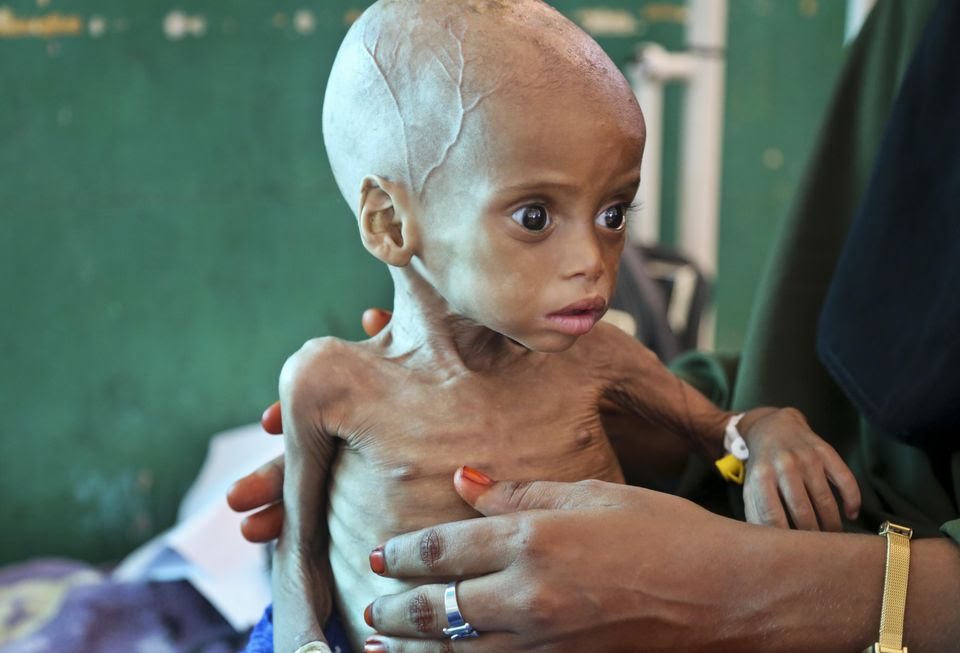 BdGEORGES's tweet photo. Au #Yémen, la guerre a provoqué l’une des pires tragédies au monde, avec des centaines de milliers de morts, et des enfants aux prises avec une faim aiguë et la famine. On peut fermer les yeux, ou choisir de regarder pour prendre la mesure de la tragédie ! https://t.co/EPKcnF1erR