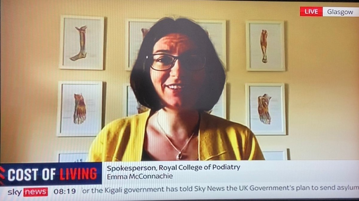 RoyColPod's tweet image. The College joined Sky News Breakfast this morning to discuss the benefits of walking. As the cost of fuel soars, switching to walking for short journeys can have great benefits. Find out more on our website at rcpod.org.uk/patient-inform…
