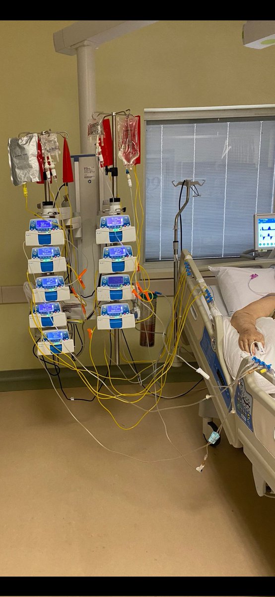 theerkekhemsire's tweet image. Yoğun bakım hemşiresi kimdir mi ? Yoğun bakım hemşiresi tam olarak bu görseli hatasız yöneten kişidir. Bunun bir de sıvı izlem kayıt kısmı var ki .. orası akıllara zarar. Bir canı yaşatmak kolay değil,bu işin içinde olmayan hiç kimse bu emeği bilemez,hayal dahi edemez.