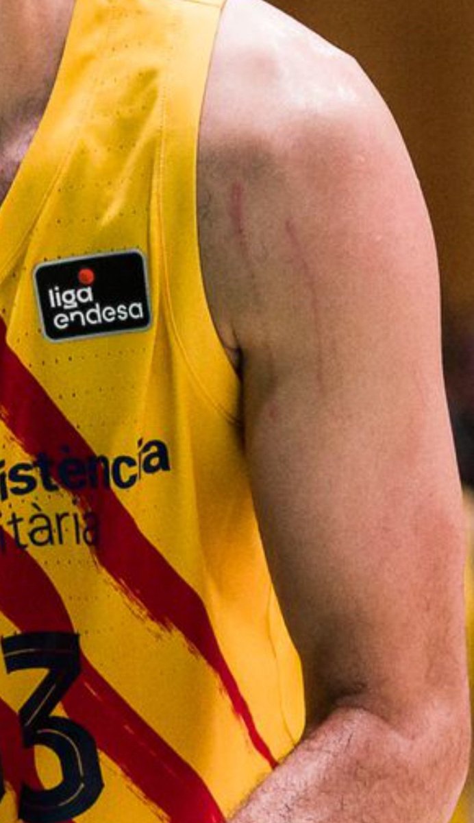 basketsincensur's tweet photo. Desde Madrid le llaman "el protegido" porque según ellos, le pitan muchas faltas a favor. Y por televisión se veían las marcas aún más. Miedo me da lo que le pueden dar en la final de la acb a Nikola Mirotic. 
Haced retweet 🔄 y que esta imagen llegue lo más lejos posible. https://t.co/8tsDFrCjlt
