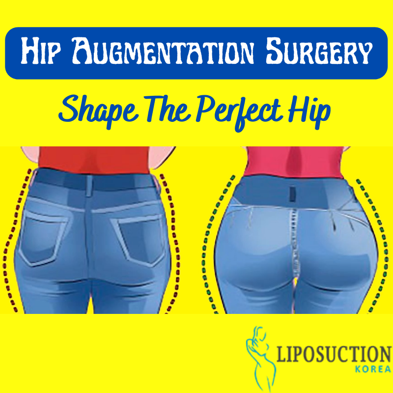 liposuctionkr's tweet photo. Hip Augmentation Surgery is a procedure designed to improve the size and shape of your hips.
It can enhance the look of your legs, increase your hip width and span..
Consult👇
Email at📩: info@liposuctionkorea.com
https://t.co/T0mfTvR1IW
➡ Inbox Us: https://t.co/RaR0IM0BPf https://t.co/Kiznh4rI5r