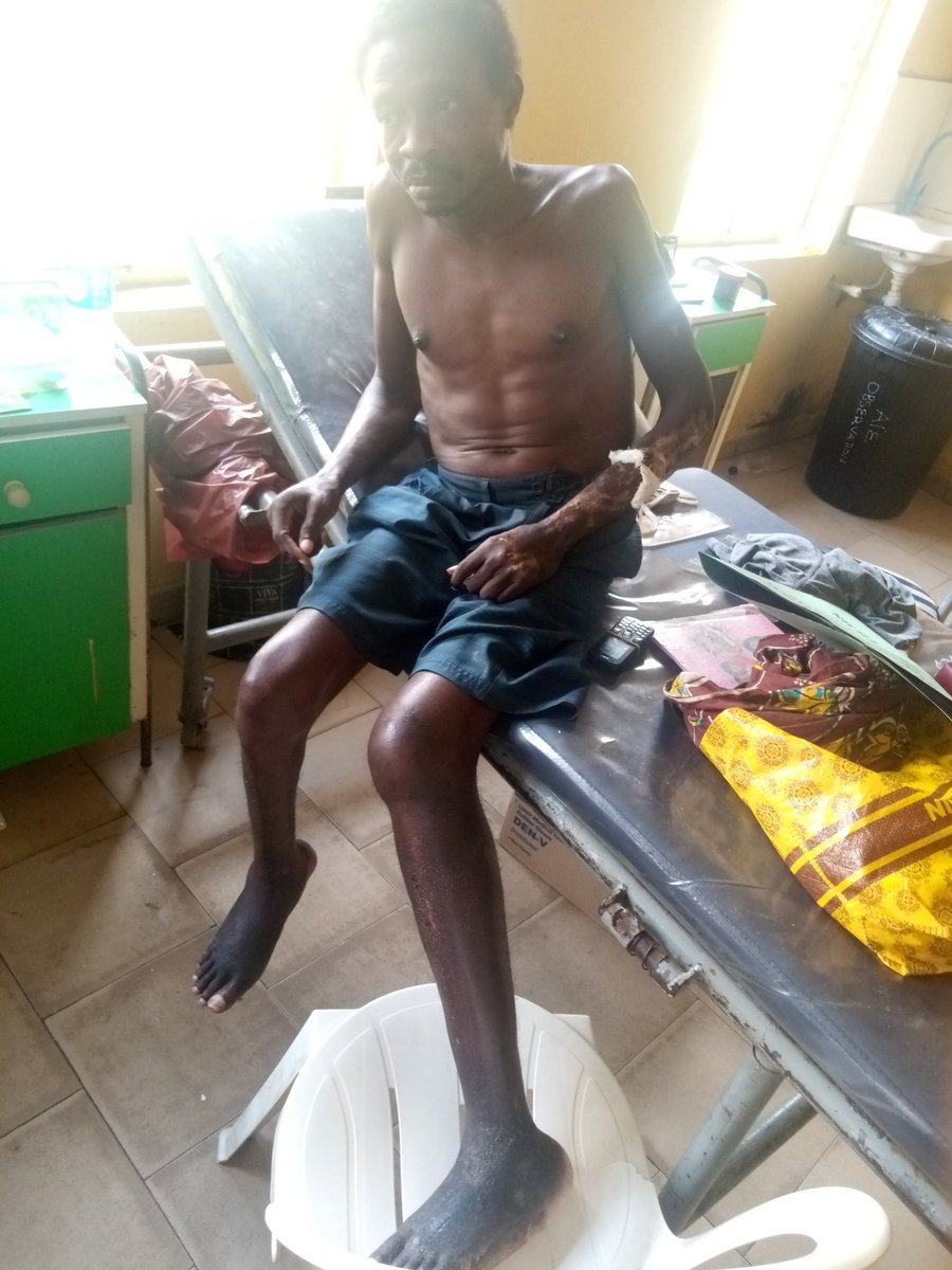 EssienTimkere's tweet photo. A PLEA FOR HELP 

This is Okure Linus, a 34 year old graduate of Urban and Regional Planning, University of Uyo. He did his one year National Youth Service in Daura, Katsina State. He's a native of Ifuho in Ikot Ekpene, Akwa Ibom State. He's currently living in pains and agony. https://t.co/owAq23Cfyc