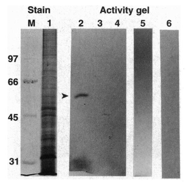 Often a major scientific discovery can be boiled down to a single plot in a paper. This is the birth of the field of epigenetic modification of chromatin by Brownell and Allis (now @RockefellerUniv) PMID: 7603997. Lane 2 is histone acetyltransferase (HAT) detected by... (1 of 3)