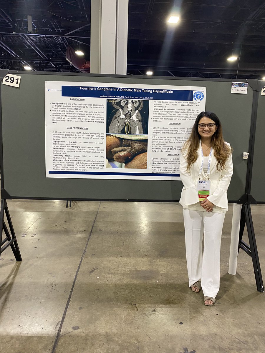 Day2 of #ENDO2022 
Stop by at my poster booth 291. I am presenting a case of Fournier’s Gangrene in a diabetic patient taking dapagliflozin @TheEndoSociety #EndoTwitter #diabetes #SGLT2inhibitors