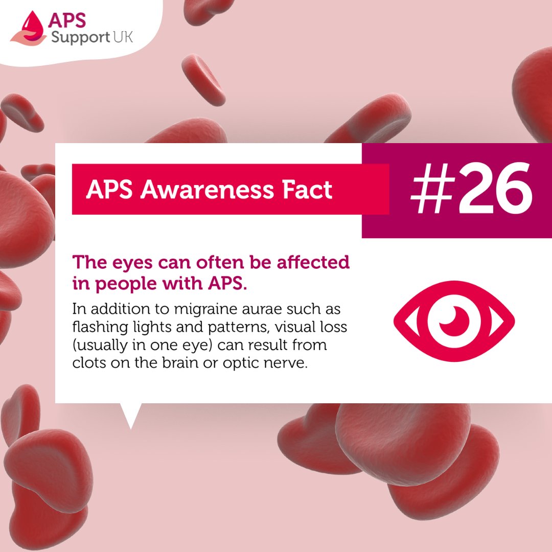 APSsupportUK's tweet photo. The eyes can often be affected in people with #APS. In addition to #migraine aurae such as flashing lights & patterns, visual loss can result from clots on the brain or optic nerve.
Find out more on our website: https://t.co/EJ8PGzccvB
#APSMatters #APSAM22 #APSAwarenessMonth https://t.co/l1L0IlIm0U