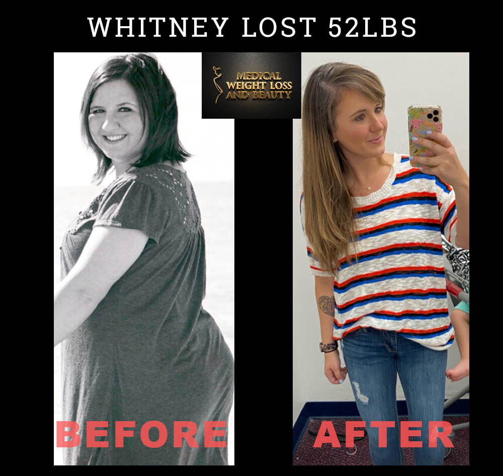 Losing weight doesn't have to be difficult. You don't have to do anything  but eat healthy and take the right medication. Phentermine you can lose  weight quickly and easily. Phentermine is a