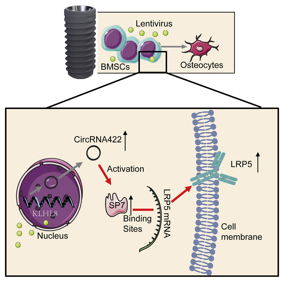 Mesenchymal Cell News (@mesenchymalcell) on Twitter photo Researchers from Zhejiang University School of Medicine identified a new circRNA, circRNA422, from rat bone 🦴 marrow #mesenchymal stem cells cultured on sandblasted, large-grit, acid-etched titanium surfaces.
<a href="/MolTherapy/">Molecular Therapy</a>
bit.ly/3Q8wnLj Researchers from Zhejiang University School of Medicine identified a new circRNA, circRNA422, from rat bone 🦴 marrow #mesenchymal stem cells cultured on sandblasted, large-grit, acid-etched titanium surfaces.
<a href="/MolTherapy/">Molecular Therapy</a>
bit.ly/3Q8wnLj
