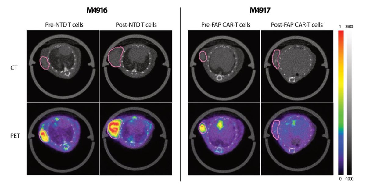 #SNMMI Abstract Highlight: Molecular imaging biomarker predicts response to CAR T cell therapy. ow.ly/3Mn550JvASg #Cancer #PersonalizedMedicine