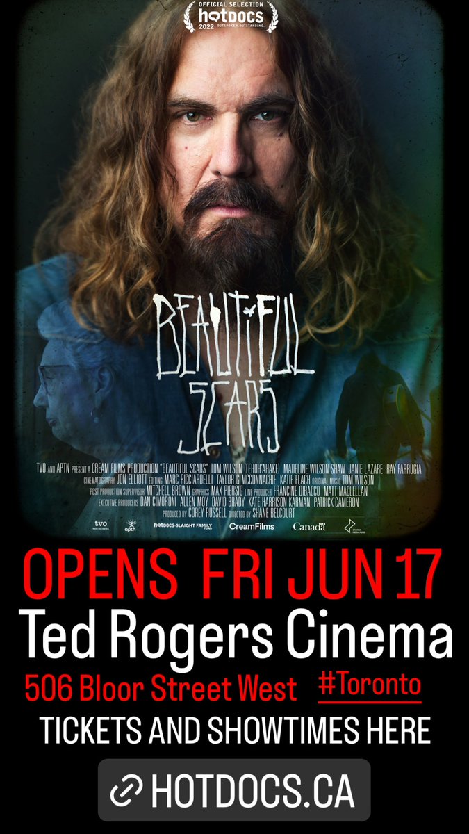 HEY TORONTO 
Beautiful Scars opens this Friday #June 27th at The Ted Rogers <a href="/HotDocsCinema/">Hot Docs Cinema</a> 
506 BLOOR Street West in #Toronto 
Tickets and Showtime Here - hotdocs.ca/whats-on/films… @hotdocs @creamfilmsprod