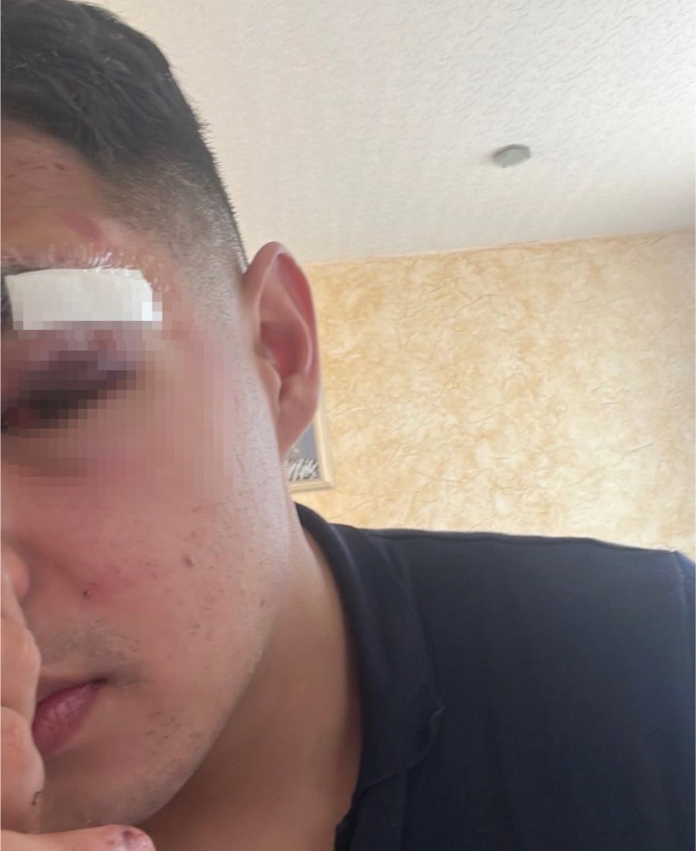 MN_PUEBLA's tweet photo. #Enterate || En #Puebla jóvenes denunciaron ser brutalmente golpeados por el personal de seguridad del establecimiento #Ferina. En redes sociales se dieron a conocer las imágenes de dicho acto, además de señalar que ya se prepara la denuncia en contra de los responsables. https://t.co/HW8bx7lVfh