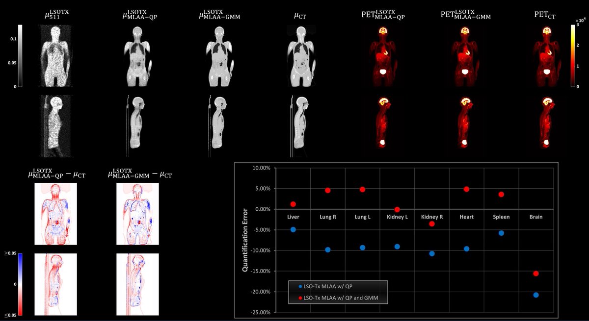 SNM_MI's tweet photo. #SNMMI22 Abstract Highlight: Novel ultra-low dose PET technique significantly reduces #radiation exposure. https://t.co/Pgn6jJtYnC

#NuclearMedicine #PETimaging https://t.co/canX87NcOy