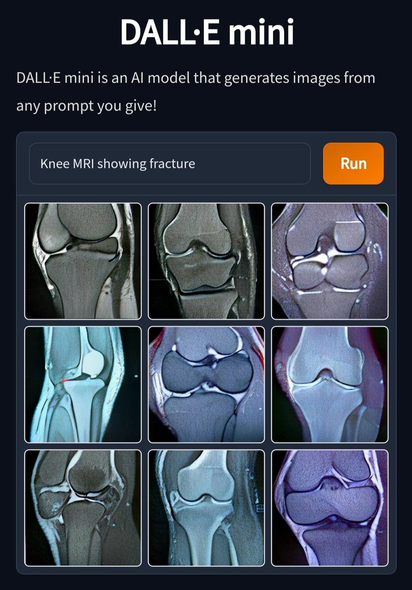 BalintBotz's tweet photo. Dall-e mini apparently prefers the coronal plane for knee MRI. Wise choice. https://t.co/Ay8TGmzO4e