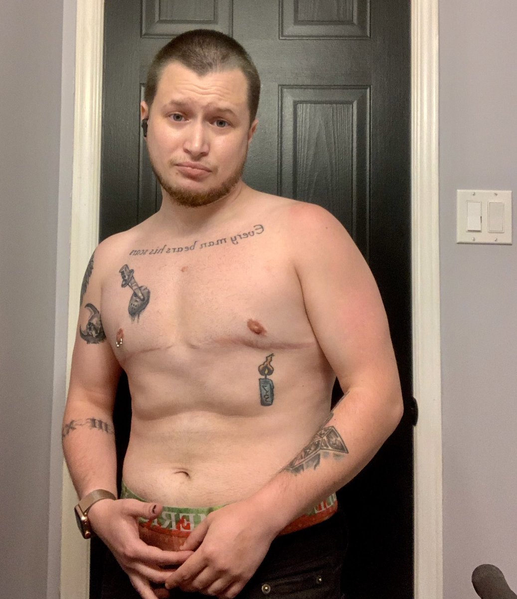 wheeliedeaf's tweet photo. Anyway I’m one week post hysterectomy and Steven Crowder can cry about the “irreversible damage” I’ve done to feel comfortable in my own body all he wants. It doesn’t change the fact that trans people exist and will always exist. https://t.co/pKfdyM1Dbb