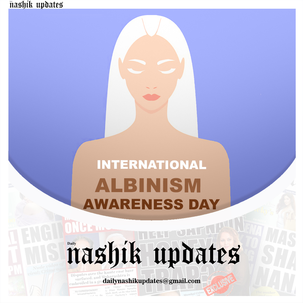 NashikUpdates's tweet photo. International Albinism Awareness Day

#AlbinismAwarenessDay #awareness #news #AlbinismDay #timesofnashik #nashikcity https://t.co/FZmTlZB8DJ