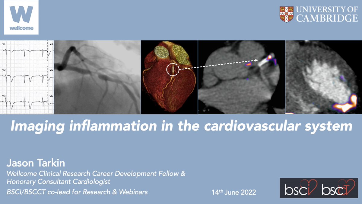 BSCI BSCCT (@bscimaging) on Twitter photo Do not miss out on our next <a href="/BSCImaging/">BSCI BSCCT</a> webinar tomorrow June 14th at 1700hrs GMT, entitled 'Imaging inflammation in the cardiovascular system'. This will be given by none other than our <a href="/BSCImaging/">BSCI BSCCT</a> lead for research and webinars <a href="/Jmtarkin/">Jason Tarkin</a> 😆
#yescct #nuclearcardiology Do not miss out on our next <a href="/BSCImaging/">BSCI BSCCT</a> webinar tomorrow June 14th at 1700hrs GMT, entitled 'Imaging inflammation in the cardiovascular system'. This will be given by none other than our <a href="/BSCImaging/">BSCI BSCCT</a> lead for research and webinars <a href="/Jmtarkin/">Jason Tarkin</a> 😆
#yescct #nuclearcardiology