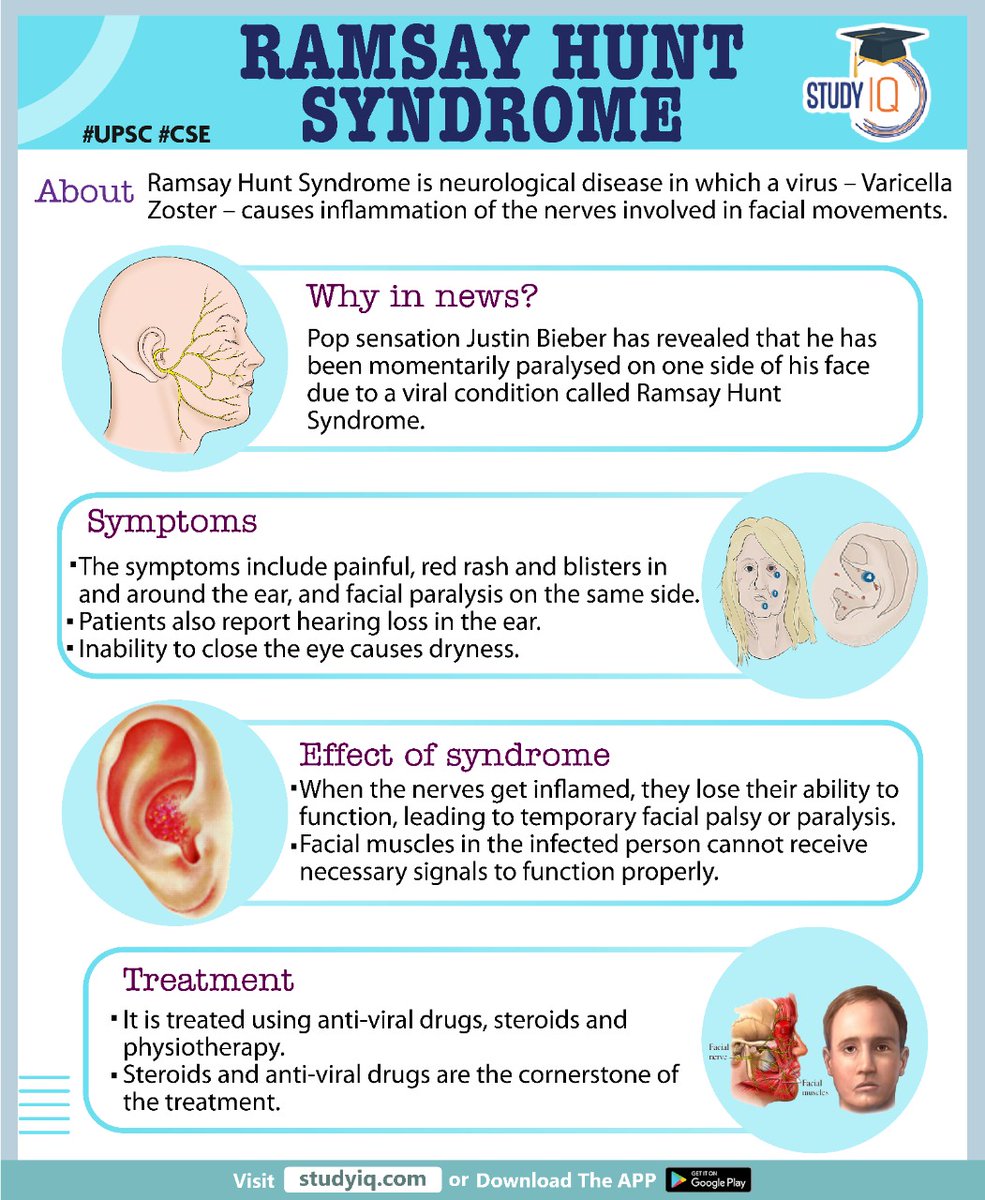 #Ramsay Hunt #Syndrome 

#ramsayhuntsyndrome #hunt #upsc #cse #whyinnews #justinbieber #virus #varicellazoster #paralysed #antiviraldrugs