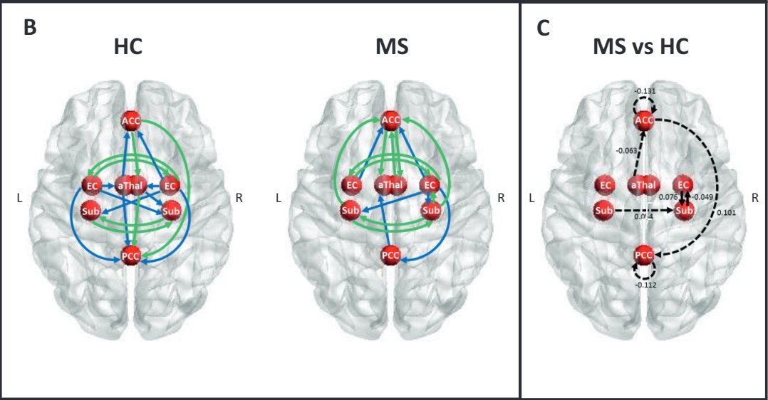molpsychiatry's tweet photo. Resting state effective connectivity abnormalities of the Papez circuit and cognitive performance in multiple sclerosis. By Olga Marchesi et al. @ReteNeuro @MyUniSR #resting-state #fMRI #effectiveconnectivity #papezcircuit #multiplesclerosis https://t.co/FoR73wlTKe https://t.co/vJqdyBqwpo