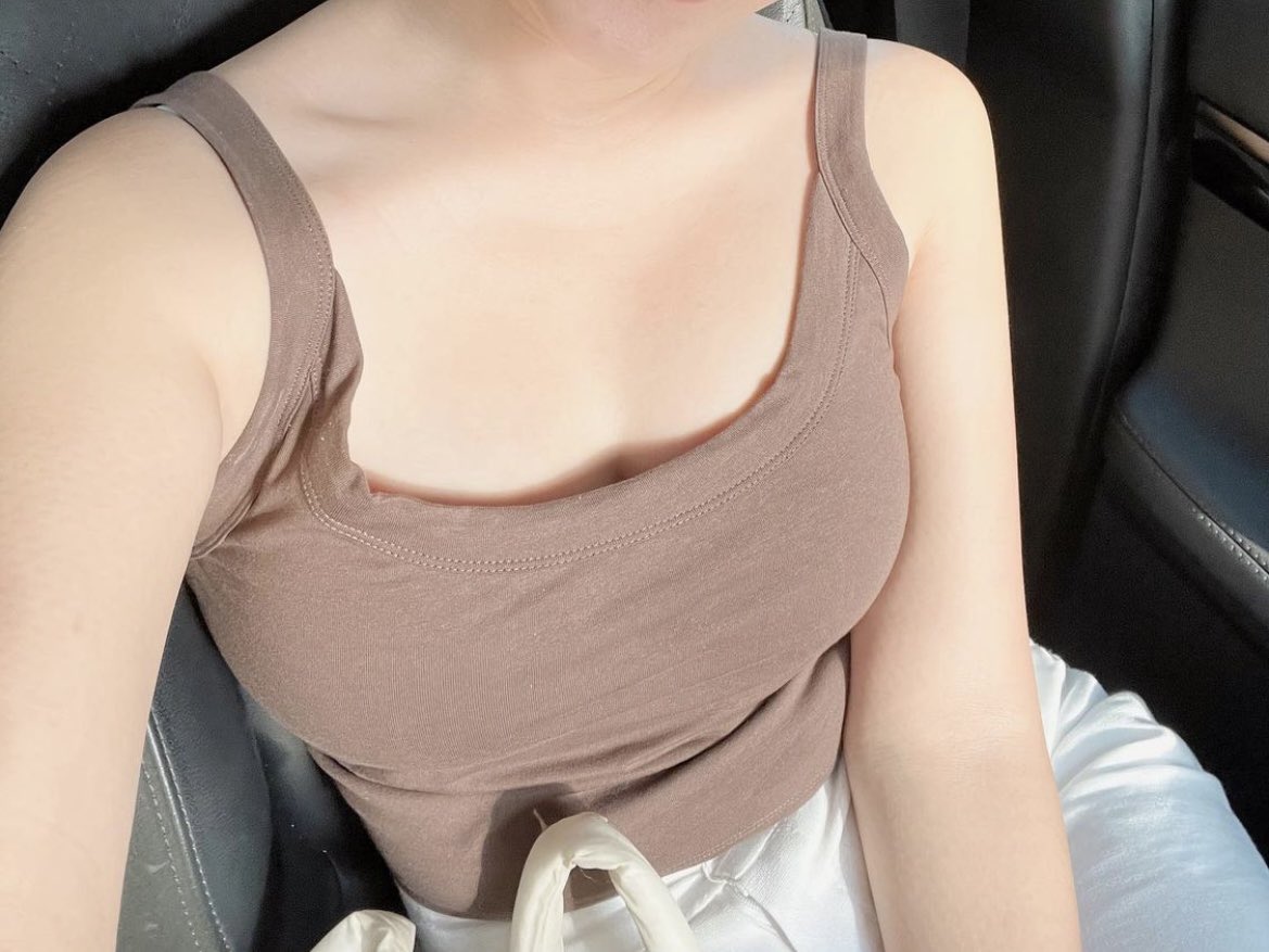 DrSatitW's tweet photo. สตรีบางท่านหน้าอกมีขนาดใหญ่จนมีปัญหา🍼
ปวดหลัง😢 มีรอยกดทับจากสายเสื้อชั้นในจนเจ็บ 👙ถูกบุลลี่🗣ขาดความมั่นใจ เสียบุคลิกภาพ ❤️💃

📝ในคนไทยอาจพบไม่มาก บางท่านไม่ทราบว่ารักษาได้

⚔️👨‍⚕️🏥ปัญหานี้สามารถรักษาได้ด้วยการผ่าตัดลดขนาดหน้าอกครับ

#breastreduction 
#liposuction 
#ดูดไขมัน https://t.co/pAwoq1GDqN